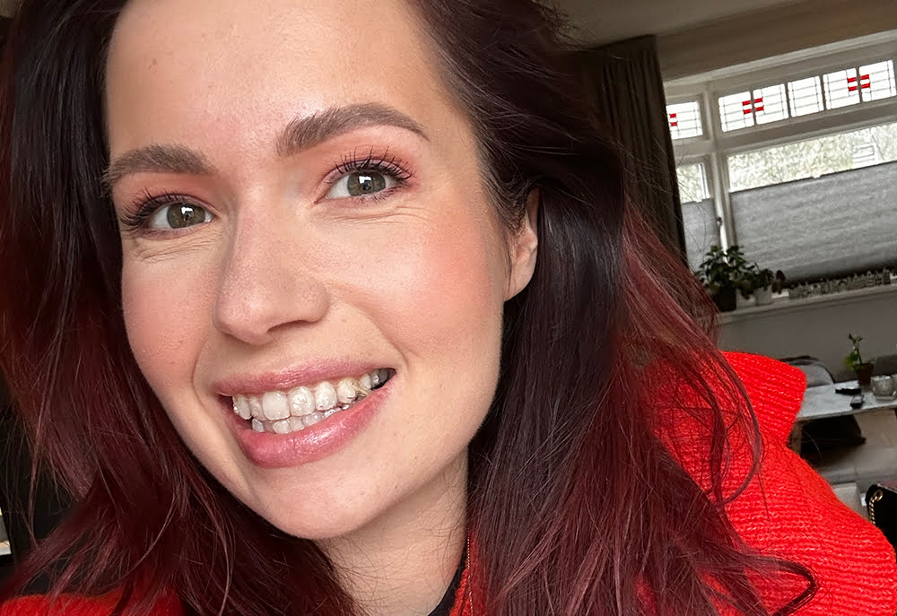 Invisalign: eerste 4 weken & eerste ervaringen • Cynthia
