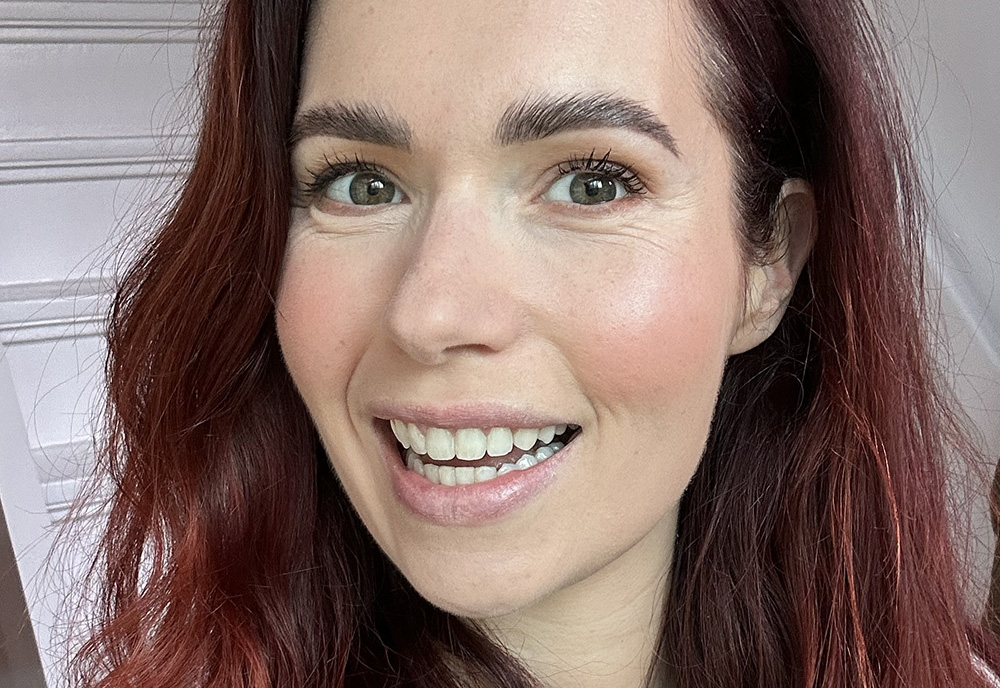 Invisalign - ik ben KLAAR - voor & na en mijn mening • Cynthia